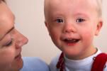 Down Syndrome Baby Facts